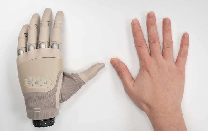 Marshall Trout, nghiên cứu sinh sau tiến sĩ tại Phòng thí nghiệm Thần kinh Robot thuộc Đại học Utah, chia sẻ về thực trạng này: "Mặc dù các cánh tay sinh học đang ngày càng trở nên giống thật, việc điều khiển chúng vẫn chưa dễ dàng hay trực quan. Gần một nửa số người dùng sẽ từ bỏ chi giả của họ, thường với lý do là khả năng điều khiển kém và gánh nặng nhận thức".