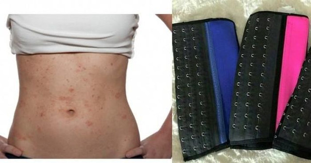 Quá lạm dụng đai nịt bụng coi chừng phản tác dụng - Hình 2 Qua lam dung dai nit bung coi chung phan tac dung-Hinh-2