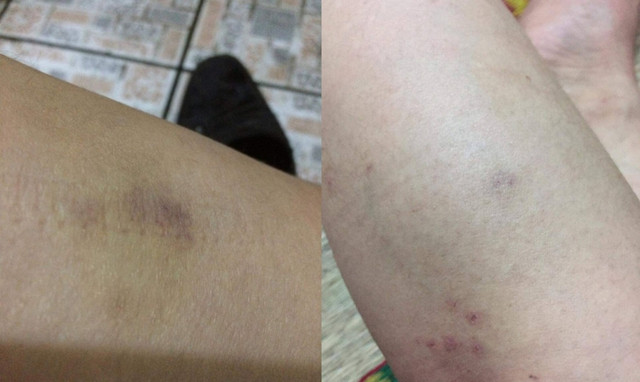 Đòi ly hôn vì bị chồng đánh đến 6 lần nhập viện cấp cứu - Hình 2 Doi ly hon vi bi chong danh den 6 lan nhap vien cap cuu-Hinh-2