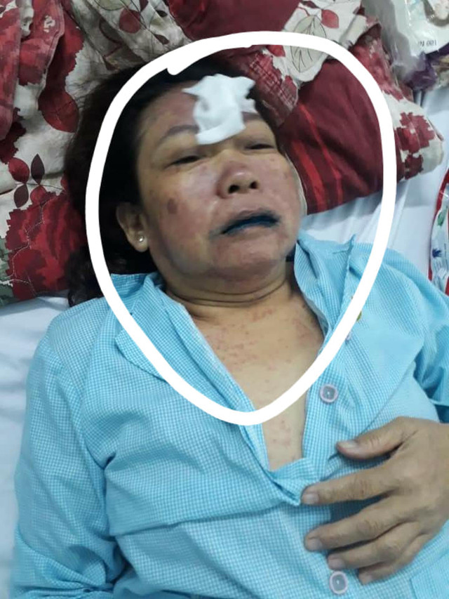 Một phụ nữ suýt mất mạng khi điều trị ở Bệnh viện Sài Gòn ITO - Hình 3 Mot phu nu suyt mat mang khi dieu tri o Benh vien Sai Gon ITO-Hinh-3