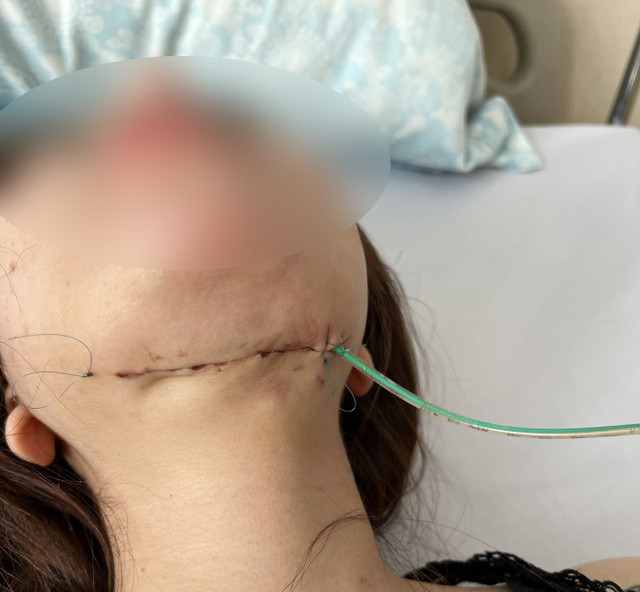 Spa “chui” tung hoành, dẹp mãi không hết: Chẳng lẽ “bó tay”? Spa “chui” tung hoanh, dep mai khong het: Chang le “bo tay”?