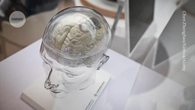 Quên Neuralink đi, chip não này làm được điều mà Elon Musk thèm muốn