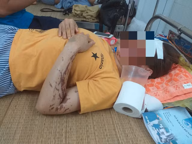 Vu tat axit vao nguoi phu bep: Nan nhan tung bi de doa giet