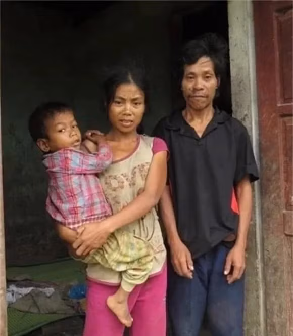 Toc nguoi Ruc dung 'phep thuat' de tranh thai, than chu chua benh-Hinh-2