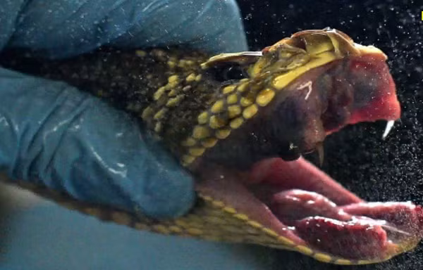 Can canh qua trinh thu noc doc ran de che huyet thanh-Hinh-5