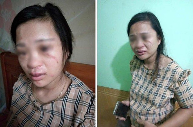 Chồng vũ phu đánh, xích chân vợ, phụ nữ ơi tiếc gì nữa... - Hình 14 Chong vu phu danh, xich chan vo, phu nu oi tiec gi nua...-Hinh-14