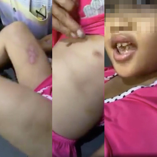 Cha dượng hành hạ, dí thuốc lá vào vùng kín bé gái 6 tuổi ở Sài Gòn Cha duong hanh ha, di thuoc la vao vung kin be gai 6 tuoi o Sai Gon