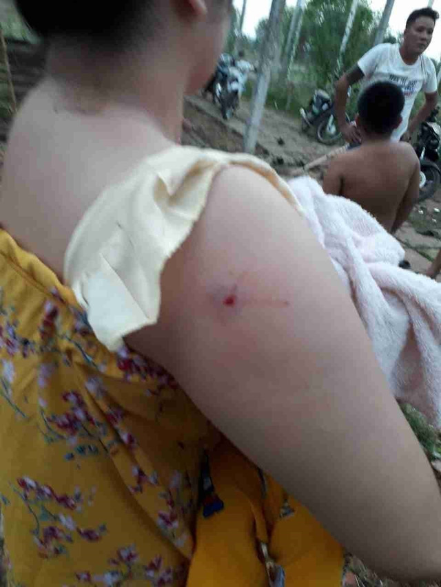 Băng giang hồ xăm trổ nổ súng truy sát cả gia đình ở Sài Gòn - Hình 5 Bang giang ho xam tro no sung truy sat ca gia dinh o Sai Gon-Hinh-5