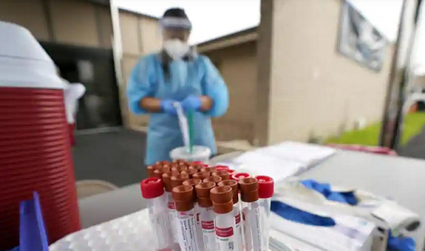 Có thêm máy phát hiện biến chủng nguy hiểm SARS-CoV-2 qua nước bọt - Hình 8 Co them may phat hien bien chung nguy hiem SARS-CoV-2 qua nuoc bot-Hinh-8