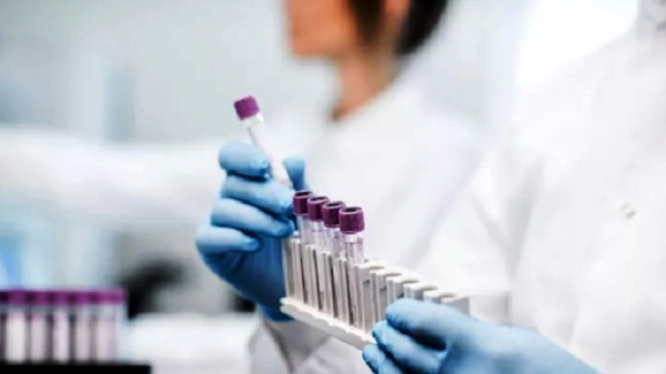 Có thêm máy phát hiện biến chủng nguy hiểm SARS-CoV-2 qua nước bọt - Hình 5 Co them may phat hien bien chung nguy hiem SARS-CoV-2 qua nuoc bot-Hinh-5