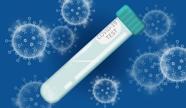 Có thêm máy phát hiện biến chủng nguy hiểm SARS-CoV-2 qua nước bọt - Hình 9 Co them may phat hien bien chung nguy hiem SARS-CoV-2 qua nuoc bot-Hinh-9