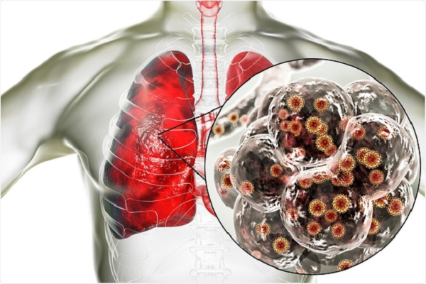 SARS-CoV-2 hoành hành mạnh nhất mùa nào trong năm? - Hình 8 SARS-CoV-2 hoanh hanh manh nhat mua nao trong nam?-Hinh-8