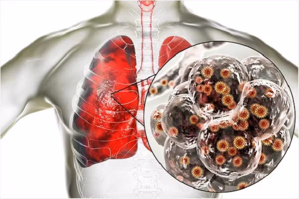 SARS-CoV-2 hoanh hanh manh nhat mua nao trong nam?-Hinh-8