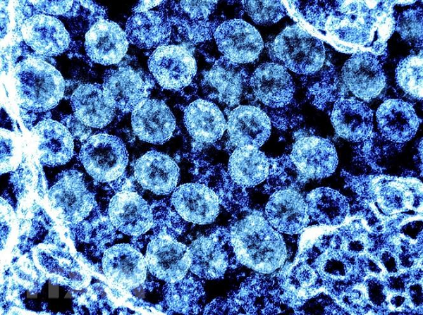 CDC Trung Quốc: Các loài nhiễm SARS-CoV-2 trong tự nhiên gia tăng khó kiểm soát - Hình 12 CDC Trung Quoc: Cac loai nhiem SARS-CoV-2 trong tu nhien gia tang kho kiem soat-Hinh-12