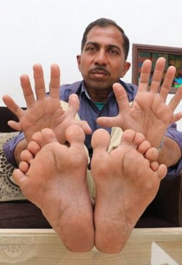 Những kỷ lục điên rồ nhất trên thế giới - Hình 4 Nhung ky luc dien ro nhat tren the gioi-Hinh-4