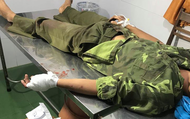 Hang chuc lam tac chem dut gan tay 1 kiem lam de giai cuu dong bon