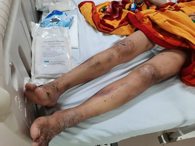 Tiếp viên bị chủ quán chích điện, ép kích dục đã xuất viện - Hình 3 Tiep vien bi chu quan chich dien, ep kich duc da xuat vien-Hinh-3