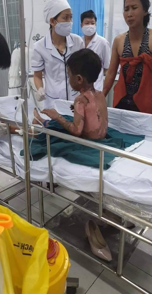 Thông tin mới nhất vụ dì đổ xăng thiêu sống cháu 6 tuổi vì khoản nợ 3,9 triệu đồng - Hình 2 Thong tin moi nhat vu di do xang thieu song chau 6 tuoi vi khoan no 3,9 trieu dong-Hinh-2