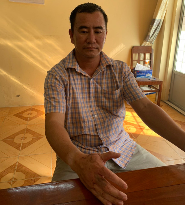 Kẻ tạt axit tạt khiến bạn tình đồng tính cùng 2 người bị bỏng ở Sài Gòn khai gì? Ke tat axit tat khien ban tinh dong tinh cung 2 nguoi bi bong o Sai Gon khai gi?