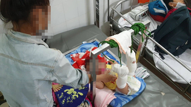 Bắt giam người cha bạo hành con ruột 4 tháng tuổi xuất huyết não, gãy xương ở Sài Gòn Bat giam nguoi cha bao hanh con ruot 4 thang tuoi xuat huyet nao, gay xuong o Sai Gon