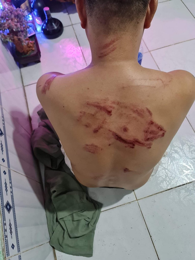Giang hồ Sài Gòn cầm hung khí xông vào nhà dân đánh người Giang ho Sai Gon cam hung khi xong vao nha dan danh nguoi