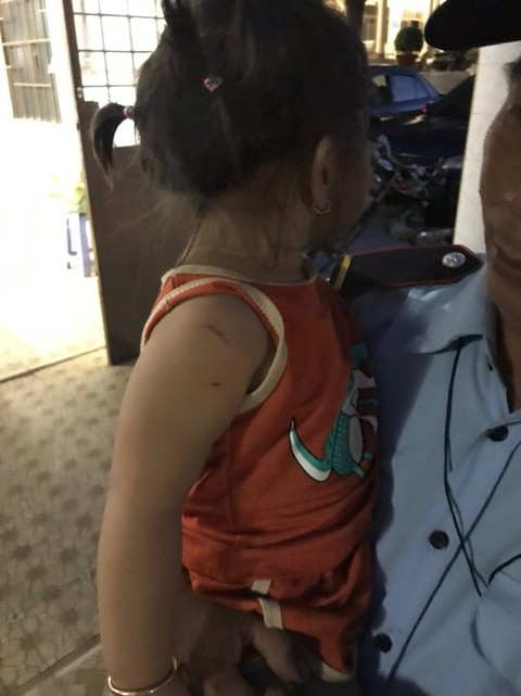 Thanh niên cướp tài sản dùng dao khống chế bé gái 3 tuổi khi bị người dân truy đuổi - Hình 3 Thanh nien cuop tai san dung dao khong che be gai 3 tuoi khi bi nguoi dan truy duoi-Hinh-3