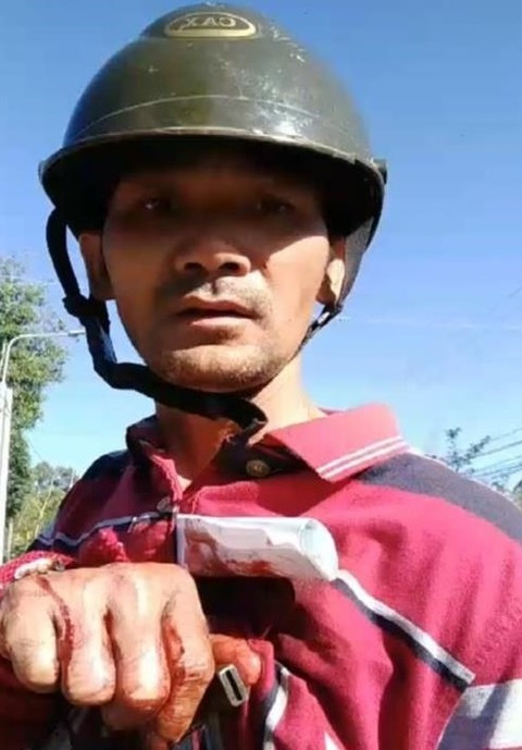 Đại tướng Tô Lâm gửi thư khen công an viên truy đuổi trộm bị đâm trúng ngực, đứt 2 gân tay Dai tuong To Lam gui thu khen cong an vien truy duoi trom bi dam trung nguc, dut 2 gan tay