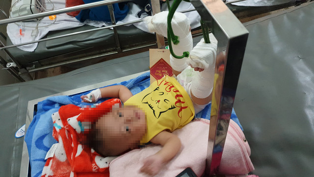 Người cha đánh con 4 tháng tuổi gẫy chân âm tính với ma tuý - Hình 2 Nguoi cha danh con 4 thang tuoi gay chan am tinh voi ma tuy-Hinh-2