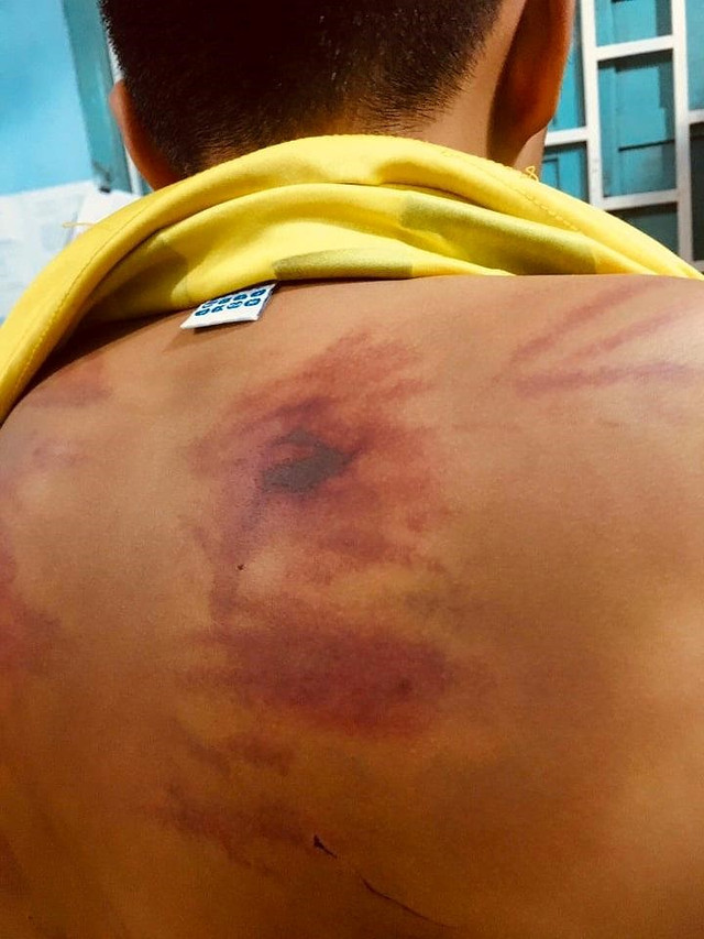Thân thể bé trai 11 tuổi rướm máu, lở loét vì bị thầy chùa đánh đập dã man - Hình 2 Than the be trai 11 tuoi ruom mau, lo loet vi bi thay chua danh dap da man-Hinh-2