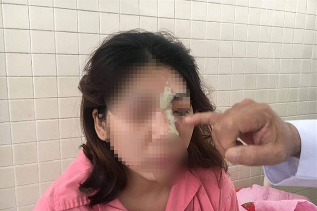 Cô gái 21 tuổi mù mắt sau khi làm đẹp tại spa Co gai 21 tuoi mu mat sau khi lam dep tai spa