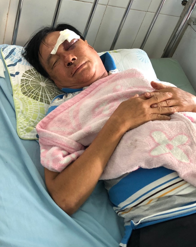 Con rể và người yêu của con gái cầm chai bia đánh cha vợ tới tấp Con re va nguoi yeu cua con gai cam chai bia danh cha vo toi tap