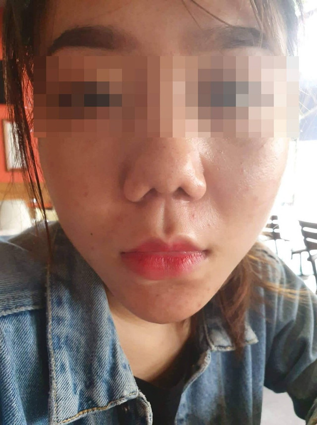 Vụ khách hàng tố Klain Beauty Center làm hỏng mũi: Công ty TNHH Klain bị phạt vì dính nhiều vi phạm - Hình 2 Vu khach hang to Klain Beauty Center lam hong mui: Cong ty TNHH Klain bi phat vi dinh nhieu vi pham-Hinh-2