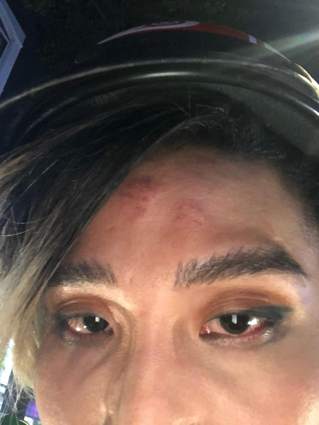 GO-VIET nói gì vụ người mẫu tố bị tài xế đánh gây thương tích? GO-VIET noi gi vu nguoi mau to bi tai xe danh gay thuong tich?