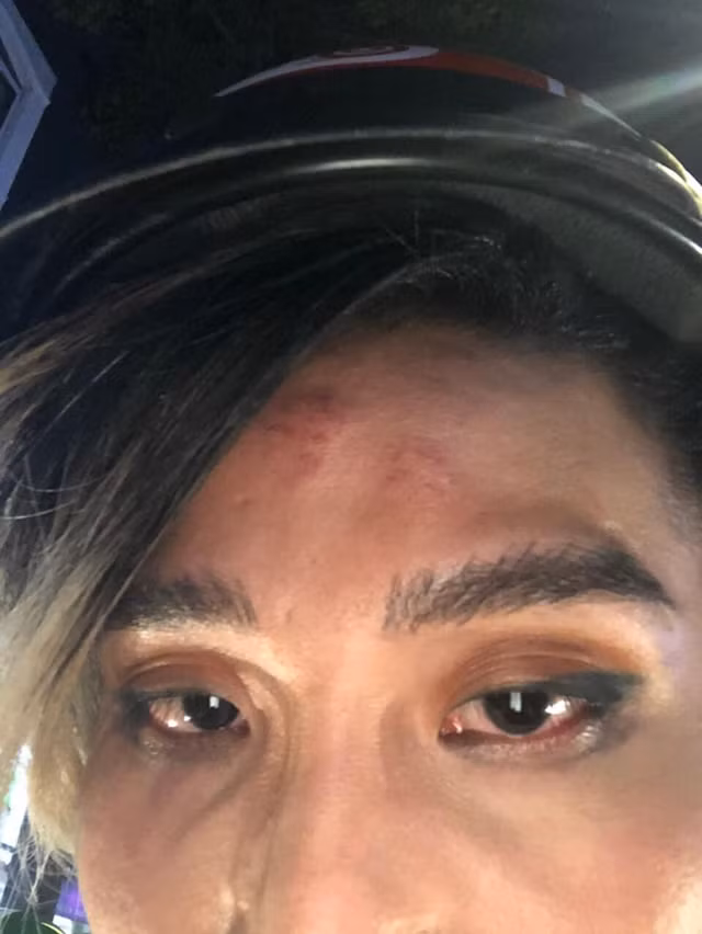 Nguoi mau Mid Nguyen to bi tai xe GO-VIET duoi xuong xe, danh gay thuong tich