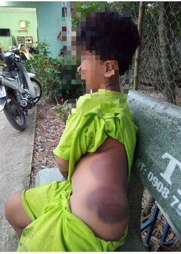 Bộ GD-ĐT vào cuộc: Đình chỉ công tác cô giáo bạo hành học sinh tại Long An Bo GD-DT vao cuoc: Dinh chi cong tac co giao bao hanh hoc sinh tai Long An