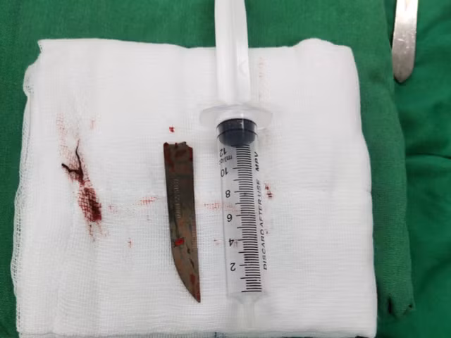 Phau thuat thanh cong cho benh nhan bi dao dam xuyen lung