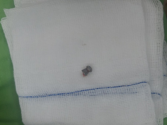 Thanh niên trộm chó bị người dân bắn thủng bụng ở miền Tây Thanh nien trom cho bi nguoi dan ban thung bung o mien Tay