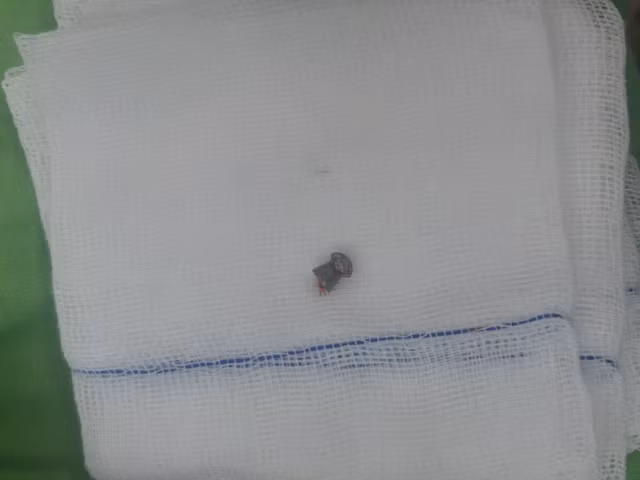 Thanh nien trom cho bi nguoi dan ban thung bung o mien Tay