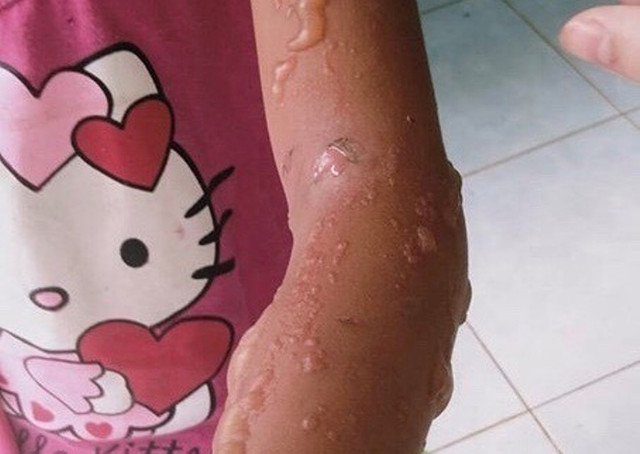 Bất ngờ với bọ 3 sọc có độc tố nhưng thương lái thu mua giá 2 triệu/kg - Hình 4 Bat ngo voi bo 3 soc co doc to nhung thuong lai thu mua gia 2 trieu/kg-Hinh-4
