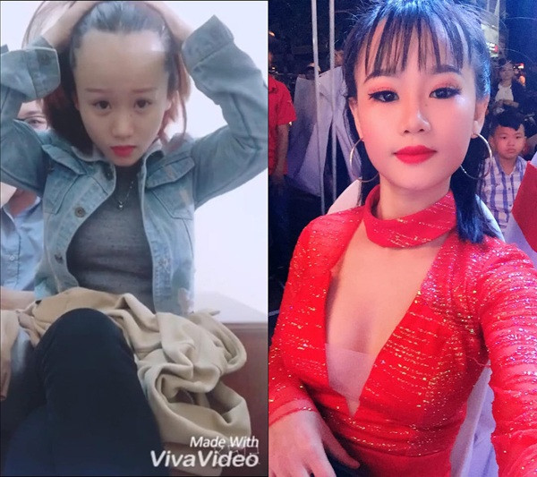 Nỗi khổ 'biết tỏ cùng ai' của các nàng khi có 'vầng trán cao vời vợi' Noi kho 'biet to cung ai' cua cac nang khi co 'vang tran cao voi voi'