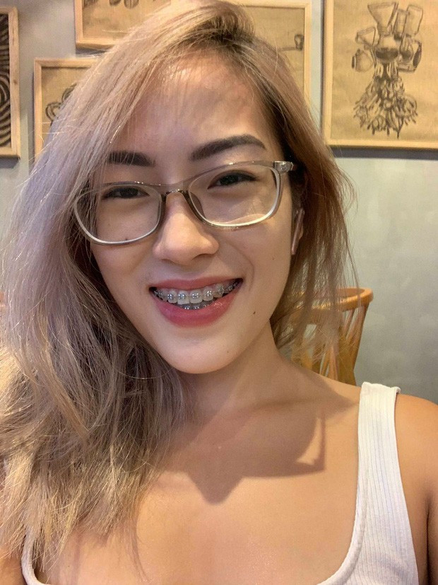 Cận cảnh body căng đét của hotgirl niềng răng Can canh body cang det cua hotgirl nieng rang