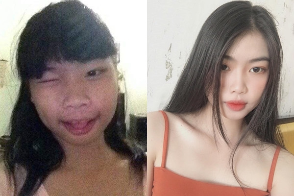 Dậy thì thành công” bị nghi dao kéo, nữ sinh Tây Ninh đáp trả đanh thép Day thi thanh cong” bi nghi dao keo, nu sinh Tay Ninh dap tra danh thep
