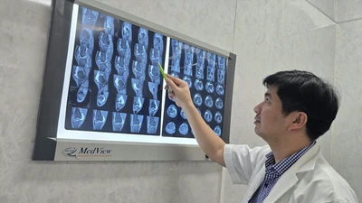 Người phụ nữ đổ gục sau 3 cú đánh pickleball