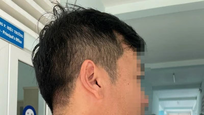 Thầy giáo bóp cổ đồng nghiệp ở Đắk Lắk đối diện hình thức kỷ luật nào? 
