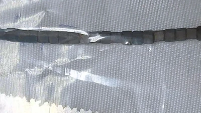 các bác sĩ phát hiện bé đã nuốt tổng cộng 24 viên nam châm dính liền với nhau, dài khoảng 5cm.