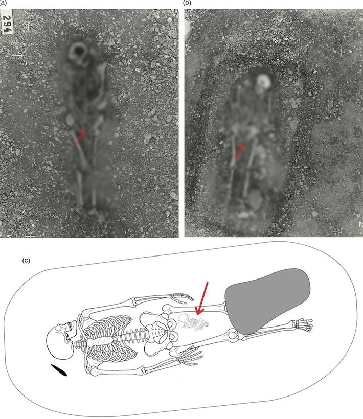 Những mảnh hài cốt của nữ chủ nhân mộ cổ cho thấy bà là một người trưởng thành trẻ tuổi hoặc trung niên. Hiện các chuyên gia không rõ liệu bà có phải tử vong khi đang mang thai hay mất lúc sinh con. Ảnh: Kopparsvik / Toplak / Matt Hitchcock.