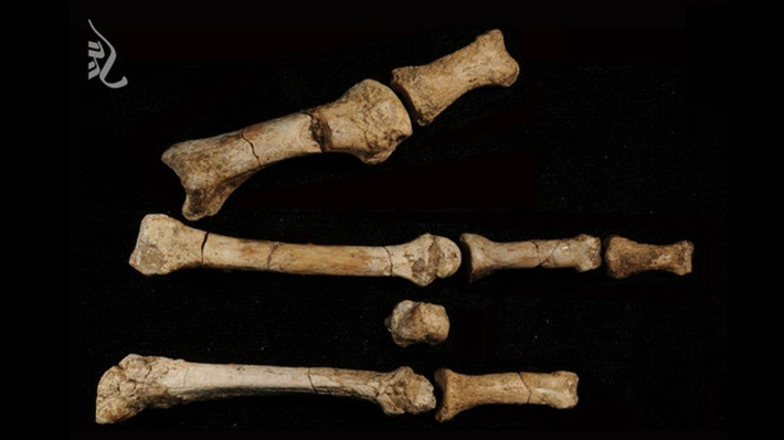 Điểm đặc biệt của "Burtele Foot" là ngón chân cái bị vẹo để thích ứng hoạt động leo trèo, nhưng chủ nhân vẫn có thể di chuyển bằng hai chân nhưng cách đi khác hẳn so với con người hiện đại. Ảnh: Yohannes Haile-Selassie / The Cleveland Museum of Natural History.