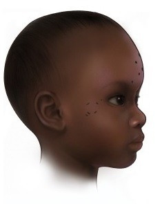 Cụ thể, các chuyên gia tìm thấy một số xác ướp bé trai 3 tuổi qua đời khoảng 1.400 năm trước. Theo đó, họ phát hiện có cả hình xăm trên mặt những đứa trẻ ở Nubia thời cổ đại bên cạnh những hình xăm ở các vị trí khác trên cơ thể. Ảnh: Mary Nguyen/©2025 UMSL.