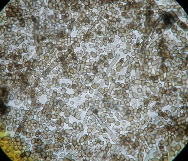 Trong số này, một loại nấm đen không những sống sót mà còn phát triển mạnh mẽ trong môi trường bức xạ cực đoan. Loài này dường như hấp thụ bức xạ để lấy năng lượng. Ảnh: Rui Tomé/Atlas of Mycology.