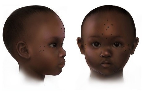 Những hình xăm có lẽ được thực hiện bằng dao thay vì kim, chủ yếu là các cụm chấm và gạch ngang. Một kiểu xăm đặc biệt phổ biến là bốn chấm tạo thành hình thoi trên trán đứa trẻ mà các nhà nghiên cứu cho rằng có thể là biểu tượng của cây thánh giá. Ảnh: Mary Nguyen/©2025 UMSL.